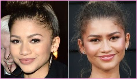 Unveiling The Truth: Zendaya's Plastic Surgery Journey
